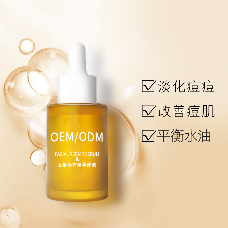 赤峰市_祛痘精华原液OEM